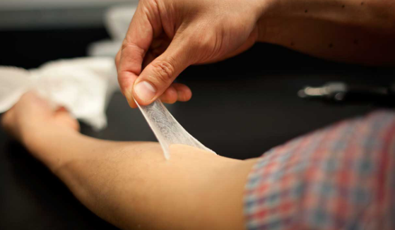 Nga chế tạo vải "da nhân tạo" để băng vết thương