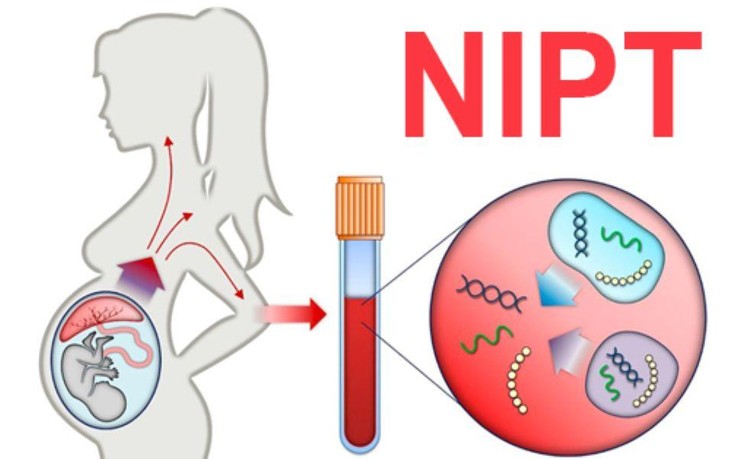 NIPT: Phương pháp phát hiện sớm dị tật thai nhi ảnh 1