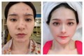 Lộ gương mặt chi chít lỗ “nữ đại gia quận 7“ làm netizen sợ