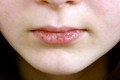 Người dễ mắc bệnh phụ khoa thường có 4 đặc điểm trên mặt