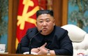 CNN: Nhà lãnh đạo Triều Tiên Kim Jong-un vừa được phẫu thuật