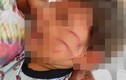 Bé 2 tuổi bị đánh tàn nhẫn vì làm hư vỏ bọc điện thoại
