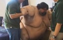 Sững sờ những tảng thịt của người đàn ông béo nhất thế giới