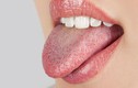 Video: Tự chuẩn bệnh chính xác 90% chỉ cần nhìn màu lưỡi