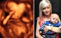 Top 10 hình ảnh siêu âm thai gây tò mò nhất