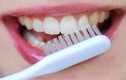 Răng bạn trông thế nào nếu quên đánh răng mỗi ngày?