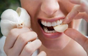 Video: Mẹo giảm đau răng nhanh nhất tại nhà
