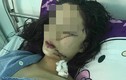 Nguyên nhân 2 thiếu nữ rạch mặt nhau kinh hoàng ở Bắc Ninh