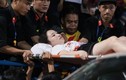 Fan nữ trúng pháo sáng CĐV Nam Định: Chủ tịch TP Hà Nội chỉ đạo gì?