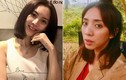 "Hoa hậu làng hài" Thu Trang công khai phẫu thuật thẩm mỹ