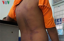 4 học sinh bị đánh bầm tím ở Cà Mau được bàn giao cho cha mẹ