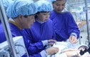 Bố mẹ cặp song sinh dính liền ở Hà Giang cảm ơn Bộ Y tế
