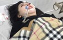 Cô gái 22 tuổi tử vong sau phẫu thuật nâng mũi ở Hà Nội