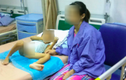Bộ Y tế xác nhận tin hàng loạt trẻ bị sùi mào gà ở Hưng Yên
