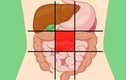 Bản đồ caro vùng bụng xác định nhanh nguyên nhân đau bụng