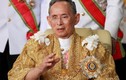 Bệnh não úng thủy của Quốc vương Thái Lan có dấu hiệu gì?