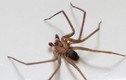 Hãi hùng nhện độc chui vào tai trú ngụ