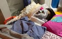 Việt kiều bị tạt axit, cắt gân chân: Công bố điểm nhận dạng 2 nghi phạm
