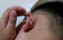 Giáo viên đâm ghim xuyên tai “mầm non Trung Quốc“