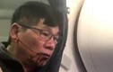 United Airlines bồi thường "khủng" cho bác sĩ Dao 