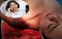 Tòa án Mỹ bác kháng án ly hôn của vợ bác sĩ Chiêm Quốc Thái