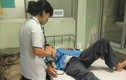 Điều dưỡng nhập viện cấp cứu vì bị bác sĩ đánh