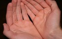 Video: Bàn tay có 1 trong 5 dấu hiệu này, càng già lại càng giàu