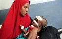 Những hình ảnh nhói lòng về nạn đói ở Somalia