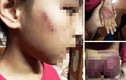 Vụ bé gái 8 tuổi bị bố trói vào cột nhà, bạo hành: Bất ngờ chia sẻ của bà nội