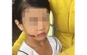 Thêm tình tiết mới trong vụ bé gái nghi bị bạo hành ở Kiên Giang