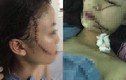 Tâm sự đẫm nước mắt của chị cô gái bị tấn công phải khâu 60 mũi