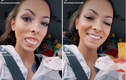 Cô gái 24 tuổi thích khoe hàm răng giả khiến dân mạng sửng sốt