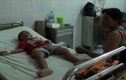 Bé trai 6 tuổi suýt chết vì bị bạch tuộc cắn