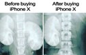 Cười đau ruột với những tấm ảnh chế iPhone X