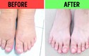 10 cách ngâm chân giúp trị một số vấn đề sức khỏe khó chịu