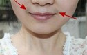 Bắt bệnh “vùng kín” qua các dấu hiệu dễ thấy trên khuôn mặt
