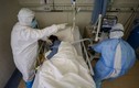 Bệnh nhân 428 tử vong vì nhồi máu cơ tim trên nền bệnh lý nặng và mắc COVID-19