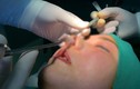 Cô gái Lâm Đồng phẫu thuật thủng mũi: “Khui” thẩm mỹ viện gây chết người