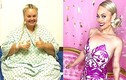 Nàng “búp bê Barbie” phẫu thuật cắt bỏ 80% dạ dày lột xác cực xinh