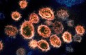 4 biến chủng virus SARS-CoV-2 ở Việt Nam nguy hiểm thế nào?