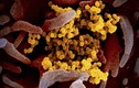 Bé gái 6 tuổi người Mỹ tử vong do các biến chứng của virus SARS-CoV-2