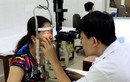 Bộ Y tế khuyến cáo khẩn biện pháp phòng bệnh đau mắt đỏ