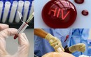 Những vụ công an, bác sĩ phơi nhiễm HIV kinh hoàng nhất VN