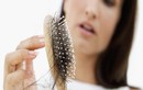Rụng tóc thường xuyên báo hiệu bạn đang stress nặng