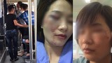 Nữ phụ xe bus Mỹ Đình - Chùa Hương bị 4 thanh niên hành hung trầy mặt