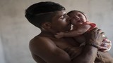 Virus ăn não người Zika là mối đe dọa lớn với Việt Nam 
