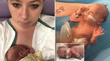 Cuộc chiến giành sự sống của bé sinh non 24 tuần và mẹ