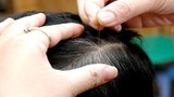 4 bài thuốc chữa tóc bạc sớm đặc biệt hiệu quả 