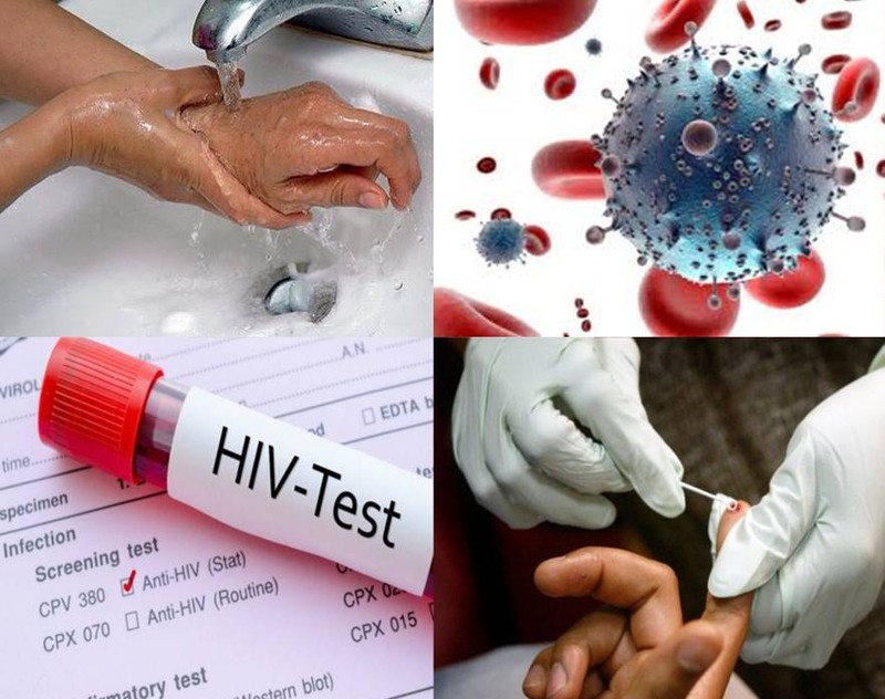 Ngay khi phat hien phoi nhiem HIV, can phai lam gi?-Hinh-3