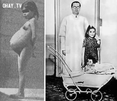 Bà mẹ kỳ lạ nhất thế giới đầu tiên phải kể đến là Lina Medina. 